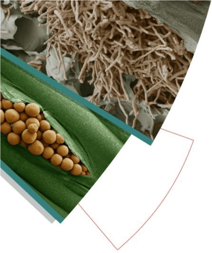 Septoria og rost